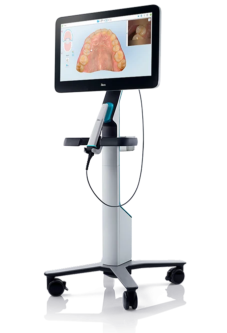 Scanner intraoral iTero Element mostrando a arcada digitalizada em 3D